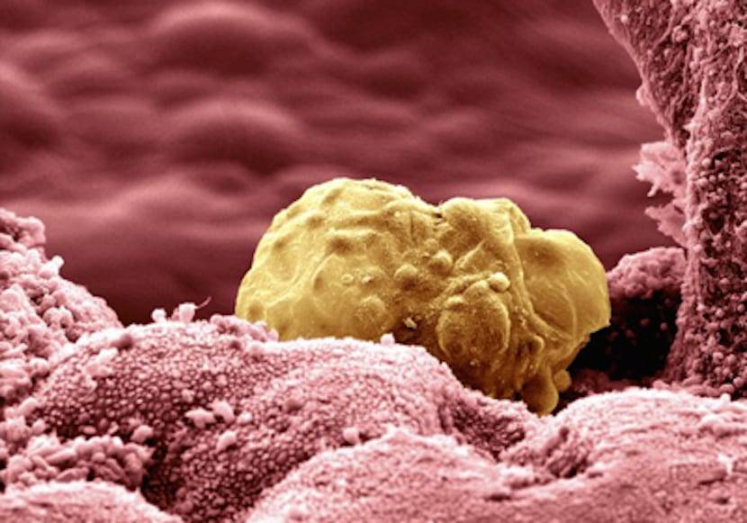 Hamileliğin 4. Haftası: İmplantasyon, Kanama ve İlk Belirtiler